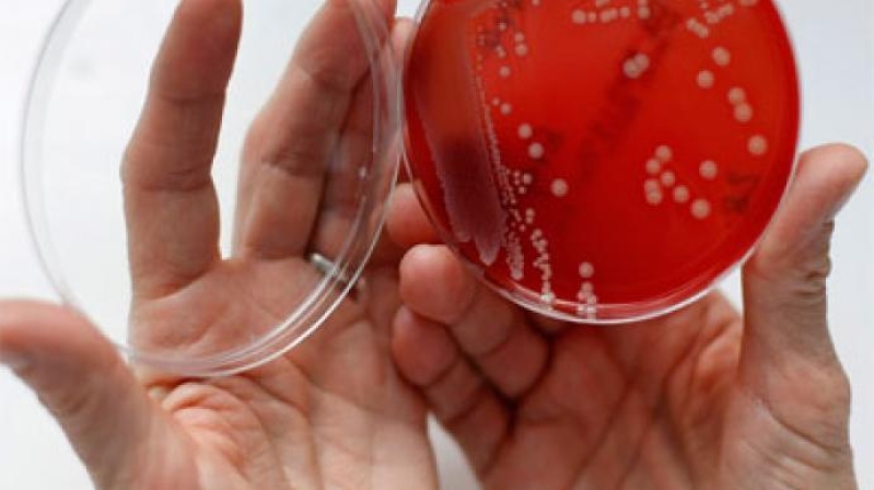 MRSA Superbug