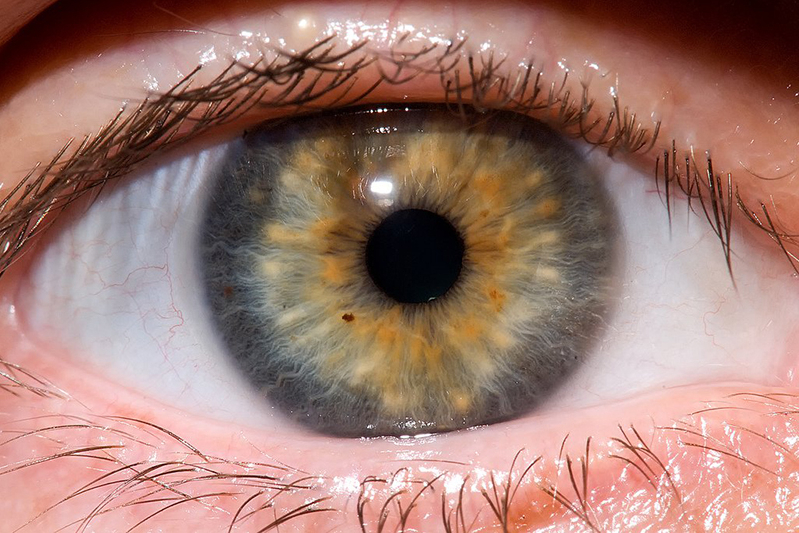 Eye Ebola