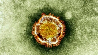 What is MERS Virus? Signs, Symptoms and Treatment; How to Prevent It? Prevention