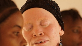 Tanzanian Albinos, Harassed and Persecuted All Their Lives, Sing Their Healing in Powerful Songs