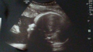 Image of Jesus Christ Appears 'Watching Over' Unborn Baby in Sonogram: 'It's a Blessing'